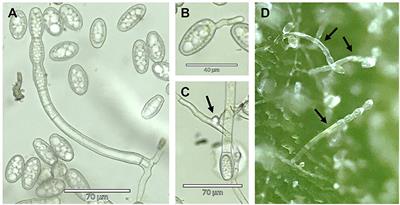 Discovery and Genetic Mapping of PM1, a Powdery Mildew Resistance Gene in Cannabis sativa L.